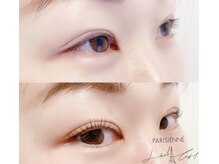 ロカヒ(Lokahi)/＊ビフォアーアフターです＊