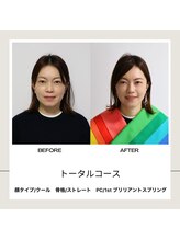 シュアリー(Surely)/トータルコースお客様事例