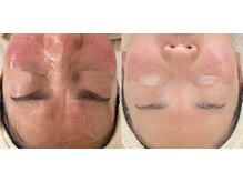 クラルテ(CLARTE)/敏感肌の方もお任せください♪