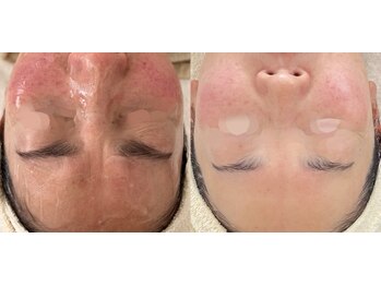 クラルテ(CLARTE)/敏感肌の方もお任せください♪