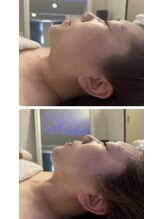 リシア(RECIA)/横顔美人に