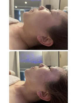 リシア(RECIA)/横顔美人に