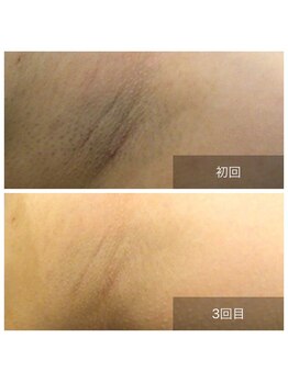 アネル うるま店(anel)/