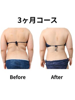 ホワイトビューティーラボ(White Beauty Lab)/3ヶ月で背中美人