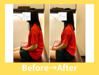 こころ整骨院/２0代女性のビフォーアフター