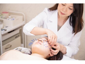 ハリリーナ 静岡(Haririna)の写真/【美顔鍼×フェイシャルエステ】小顔美鍼(70分)¥5,500!初めての美顔鍼ならハリリーナにお任せ☆