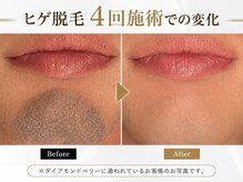 ダイアモンドベリー