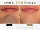 ダイアモンドベリーの写真