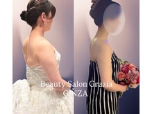 グラツィア 銀座(Grazia)/8回【 ブライダルエステ整体 】