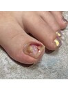 foot ワンカラー+親指art