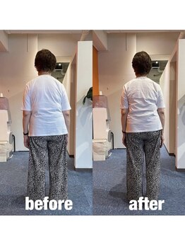 カワル整体 上通り院/【コルセットが痛みの原因?】