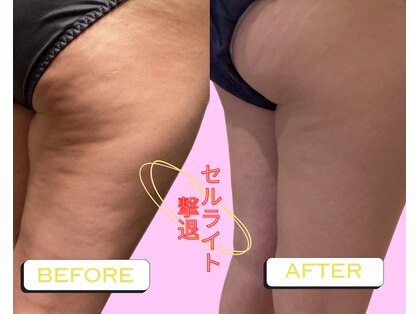 ヨサパーク ミミ 高野店(YOSA PARK mimi)の写真