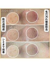 フレル(FUREL)/トラブルの起きにくい肌へ