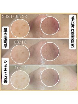 フレル(FUREL)/トラブルの起きにくい肌へ