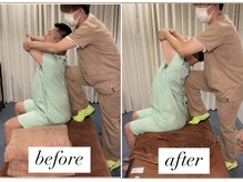 ヤマモト 表参道院(YAMAMOTO)/猫背、姿勢不良を改善！！