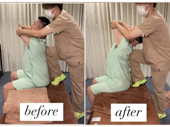 ヤマモト 表参道院(YAMAMOTO)/猫背、姿勢不良を改善！！