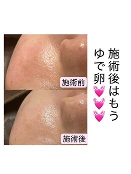 ラウレア(Laule’a)/憧れのツヤ肌へ☆