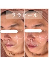 チェリーブロッサム 恵比寿店(CHERRY BLOSSOM)/ララピール