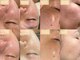 サロンドエテ(salon de ete)の写真