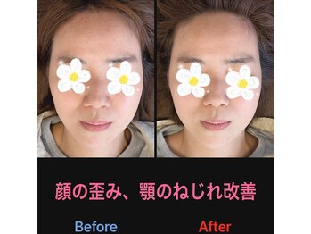 美容矯正サロン レレポノ(LELEPONO)/