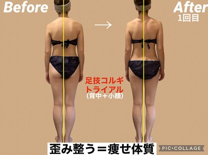 レアフィート(Rheafeet)の写真