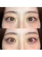 フィグ(fig)/ラッシュリフト