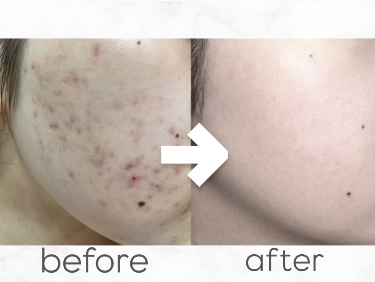 ベル 堀江(Belle)｜ホットペッパービューティー