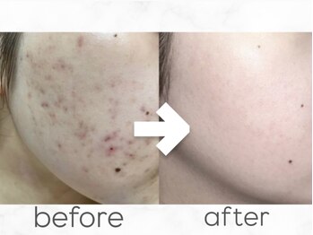 ベル 堀江(Belle)