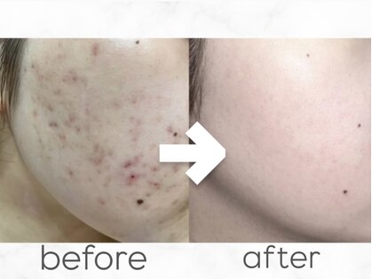 ベル 堀江(Belle)の写真