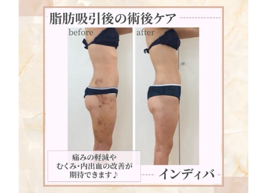 谷町九丁目駅でインディバが人気のエステサロン｜ホットペッパー