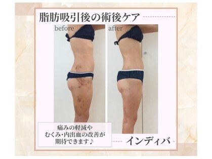 カノン(Kanon.)の写真