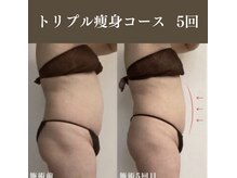 サロンドペシェ(salon de peche)/50代＊トリプル痩身コース5回目