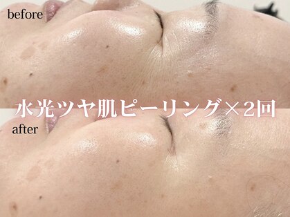 アディクトウラ(Addict'ula)の写真