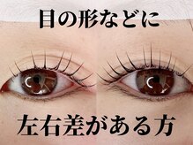 エースラッシュエヌ(A/N)/目の形などに左右差があっても◎