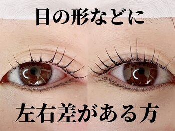 エースラッシュエヌ(A/N)/目の形などに左右差があっても◎