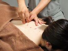 ボディケアプラス(Bodycareplus)