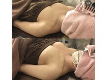 ヴィーナス(Venus)/バストアップ