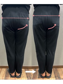 ブラックスワン(Black Swan)/美尻骨盤矯正 ¥15,800