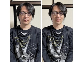 ミントのかべの整体院/小顔矯正ビフォーアフター