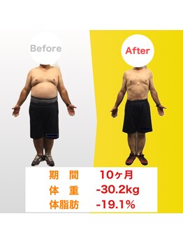 リーブス(REVES)/50代男性 期間10ヶ月