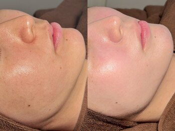 ルーナジェーナ(Luna llena)/