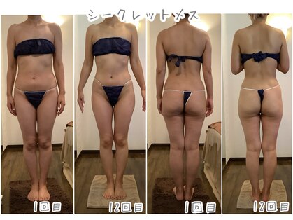 エステティックジュネス(JEUNESSE)の写真