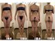 エステティックジュネス(JEUNESSE)の写真