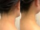 フルール(fleur)の写真/新郎新婦で通えるペアプランがおすすめ♪特別な日を迎えるあなたの為に!潤いに満ちた綺麗に輝く花嫁に☆