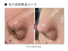 ヴィナチュール(vie nature)/ ■毛穴ケア