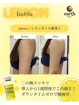 プラチナアース 守谷店(Platinum earth)/痩身ビフォーアフター