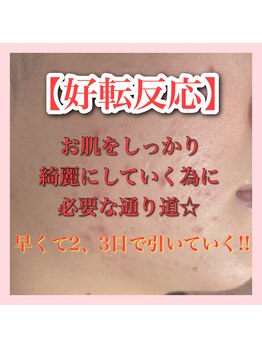 アルムダアクア 天王寺店(Aleumda AQUA)/ハーブピーリング/大阪/天王寺