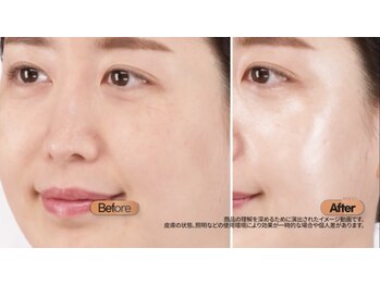 エス センダイ(S SENDAI)/マイクロパックからコースも登場