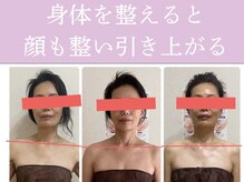 ブルーム(BLOOM)/顔の歪みは姿勢から