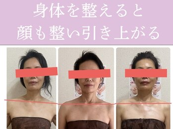 ブルーム(BLOOM)/顔の歪みは姿勢から